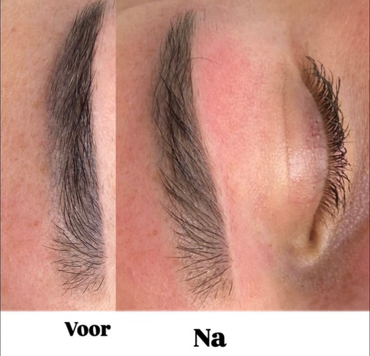 Wenkbrauwen voor en na anti-grijs behandeling met ND Yag laser — Zeist