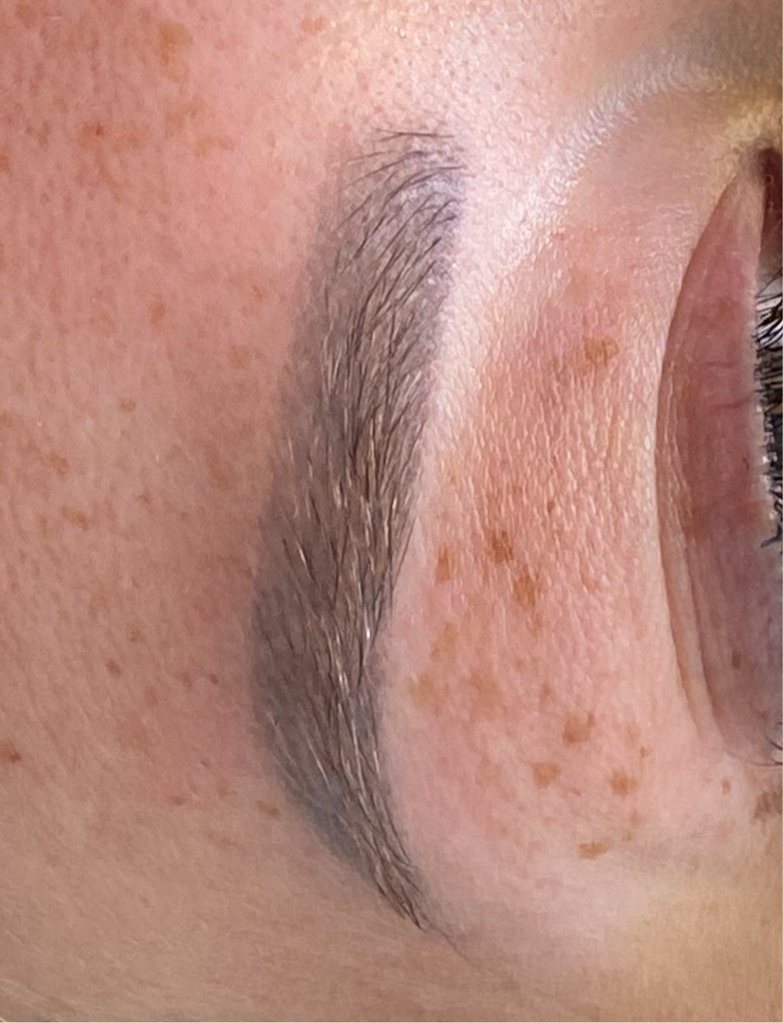 PMU removal met laser voor het veilig en effectief verwijderen van permanente make-up. Geschikt voor wenkbrauwen.