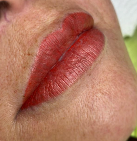Permanente lipmake-up voor meer kleur, symmetrie en definitie. Natuurlijk resultaat, afgestemd op jouw gezicht.