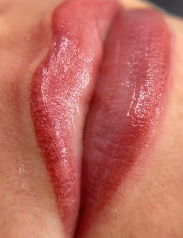 Permanente lipmake-up voor meer kleur, symmetrie en definitie. Natuurlijk resultaat, afgestemd op jouw gezicht.